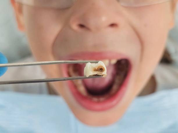 Best Emergency Dental Services for Seniors in Ridgecrest, CA