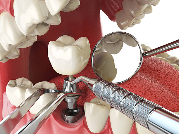Best Mobile Emergency Dentist in Ridgecrest, CA